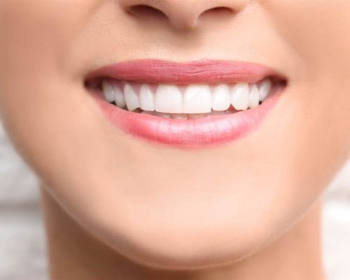 Dental Bonding near Me: Transform Your Smile with Expert Care